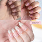 🔥Last Day-Buy 1 Get 1 Free!🎁Nail Growth & Strength Serum | 3ml Pen