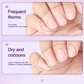 🔥Buy 1 Get 1 Free🔥3-in-1 Hand Armor Essence Pen