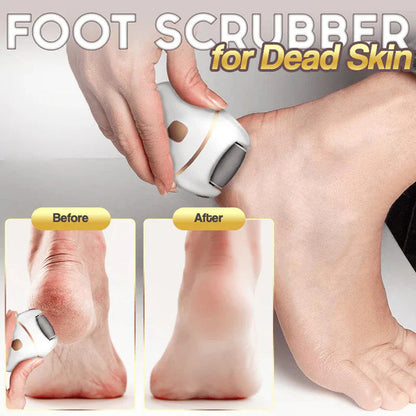 🔥HOT SALE 50% OFF🔥Rechargeable Electric Foot Exfoliating Scrubber🔥
